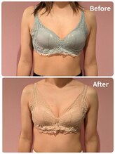 ククナ 上越店(KUKUNA)/★バストアップビフォーアフター