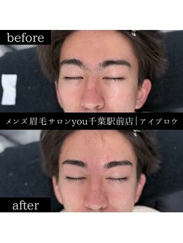 ユー 千葉駅前店(you)/ビフォ－アフター写真