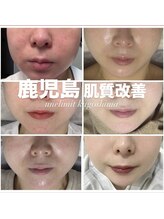 アンリミット 鹿児島天文館店(Une limit)/