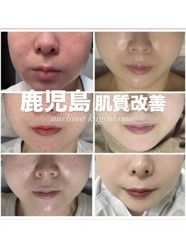 アンリミット 鹿児島天文館店(Une limit)/