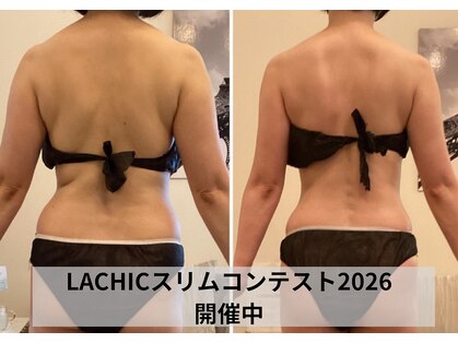 ラシク 吉祥寺(LACHIC)の写真