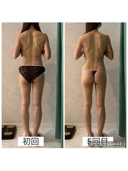 エクラ(Eclat)/Eclatの痩身★BeforeAfter2