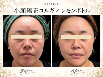 スターティス 麻布十番店(STATICE)の写真/完全プライベート空間で、結果にこだわる大人のためのマンツーマン小顔施術