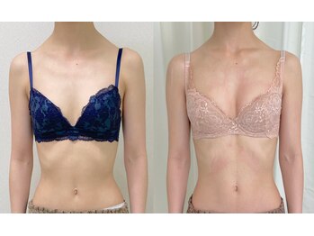 ワイサロン(Y salon)/バストアップ/4ヶ月/D→Eカップ