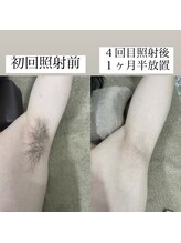 テンパ ビューティー(+10%beauty)/効果写真