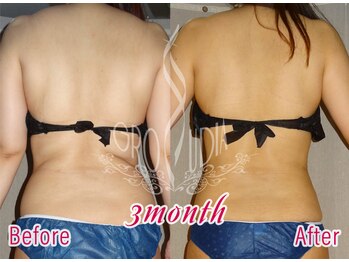 グラウディア 恵比寿/痩身/筋膜リリース/インディバ超