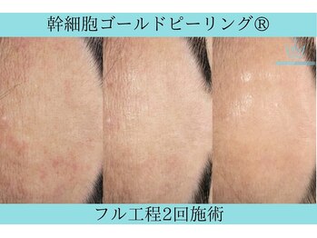 リメイク 広尾(REMAKE)/