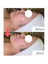 グラシア(gracia)/シミ・毛穴ケア専門店gracia