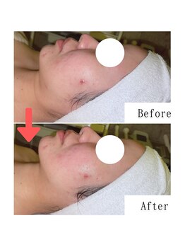 グラシア(gracia)/シミ・毛穴ケア専門店gracia