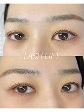 ウィロー(WILLOW)/上下ラッシュリフト