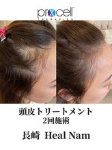 ヒルナム(Heal Nam)/プロセルセラピーズ~頭皮~