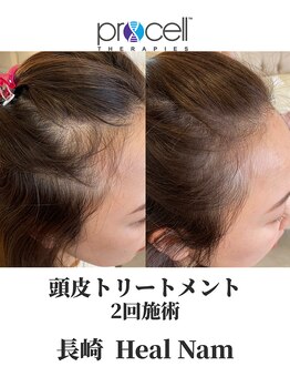 ヒルナム(Heal Nam)/プロセルセラピーズ~頭皮~
