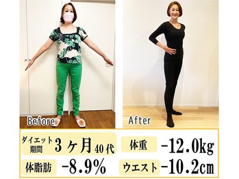 アンビジュー(un bijou)/ビフォーアフター3ヶ月◇ー12
