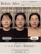 アイミーボーテ(Aime beaute)/コルギ×整体
