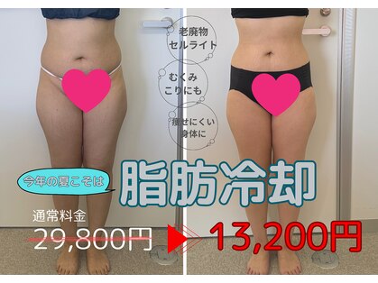 ベル(Belle)の写真