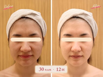 エピファニー(Epi phany Total Beauty Salon)の写真