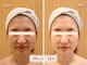 エピファニー(Epi phany Total Beauty Salon)の写真