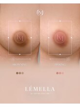 エルビービュティーサロン(LB BEAUTY SALON)/【ルメラ乳輪】実績数関西1★