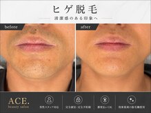 エースビューティーサロン 蒲郡店(ACE. beauty salon)の雰囲気（効果に拘って機械選びを行いました。圧倒的に効果重視）