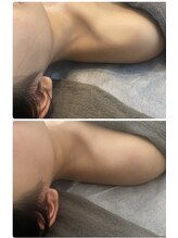 アロラヴィ(AroRavi)/巻き方解消でスタイルアップ