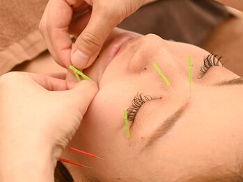 三和旭が丘院/髪の毛より細い鍼☆【美容鍼】