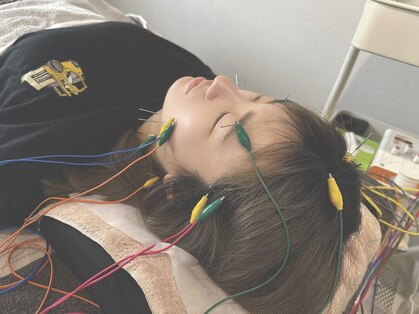 ヒップ(hip)の写真