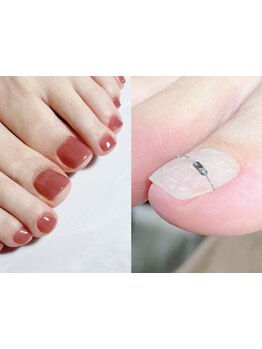 フットネイルがおすすめのサロン