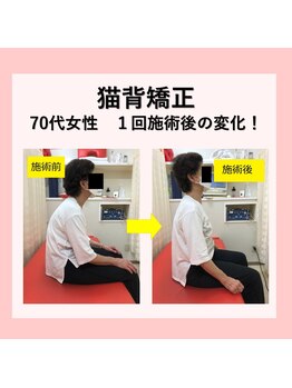 ほねつぎ長嶺鍼灸接骨院/ビフォーアフター3