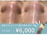 【黒ずみ・詰まり毛穴を”即”解消◎】全顔毛穴洗浄+毛穴レスパックで陶器肌
