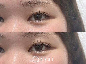 アンネ 伊丹店(ANNE)/【プレミアムラッシュリフト】