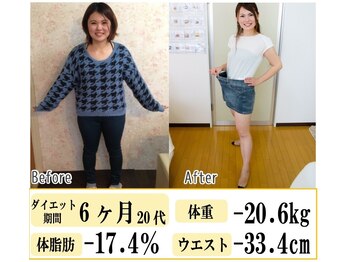 リラ(Lilas)/【ビフォアフ3】