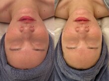 ポーデベロア(Peau des velours)/マッサージ/ホワイトタンニング