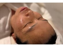 エステサロン アンジュール(Angelle)の雰囲気(大人気の毛穴スペシャルコース後のお肌。)