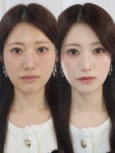 ラルムハウス 恵比寿店(RALMEHOUSE)/大人韓国メイク