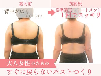 ベルフルール/バストアップ/熊本/南熊本