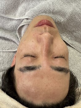 リコリス(Lycoris)/毛穴洗浄