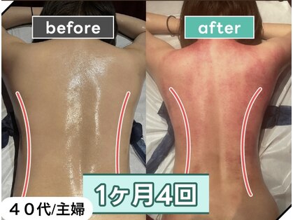 痩身革命 大宮店の写真