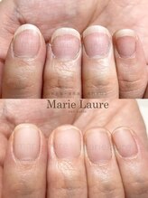 マリーロール 梅田店(Marie Laure)/自爪育成/深爪矯正/ネイルケア