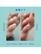 ピーアンドオー(P&O)/