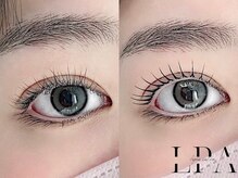 レピア 盛岡店/韓国式LEPIA Before&Aｆter