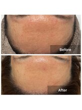 リノリー(rinory)/化粧品