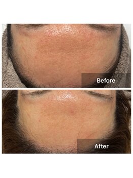 リノリー(rinory)/化粧品