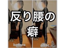 カワル整体 上通り院/反り腰の癖