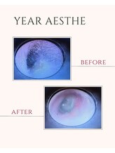 スリーバイザサロン フジサワ(THREE by the salon fujisawa)/イヤーエステ