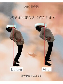 ABC整体院/腰痛整体のビフォーアフター