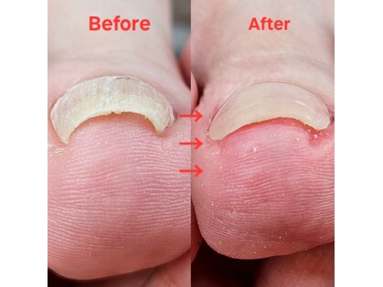 エムズリネイル(M’srenail)の写真