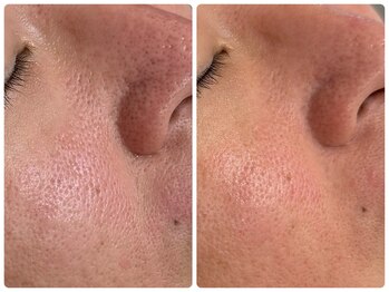 シェミー(CHEZ MEE)/年齢肌に♪潤い/ハリ/艶肌を実感