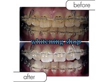 ホワイトニングショップ 鳳店の雰囲気(飲食・タバコ制限一切なし)