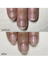 【自爪育成】before after