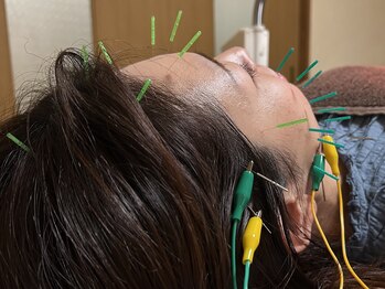 りんどう鍼灸院の写真/【首肩こり/腰/全身疲労に「鍼灸」という新しい選択肢】知る人ぞ知る[鍼灸施術]で利用者から喜びの声多数◎